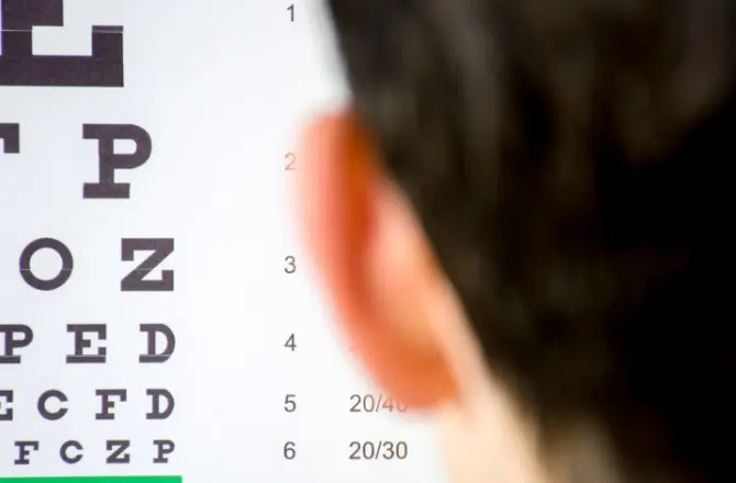 Visual acuity test 