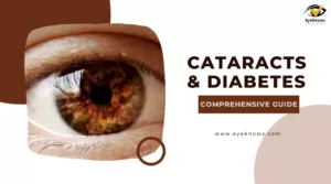 Cataracts And Diabetes: A Comprehensive Guide For All