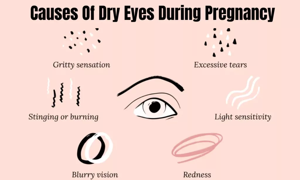 Causes Of Dry Eyes During Pregnancy