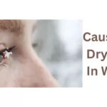 Causes Of Dry Eyes In Winter