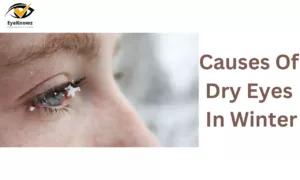 Causes Of Dry Eyes In Winter