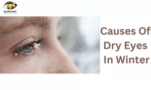 Causes Of Dry Eyes In Winter | Treatment, Preventions & More