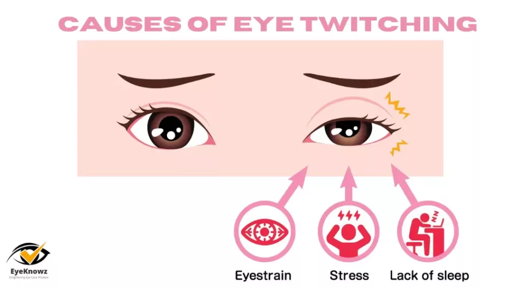 Causes Of Eye Twitching 1