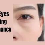 Dry Eyes During Pregnancy