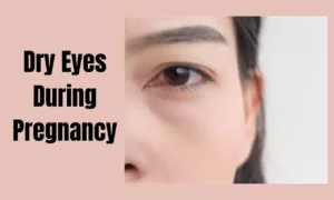 Understanding & Managing Dry Eyes During Pregnancy | Unlocking The Mystery