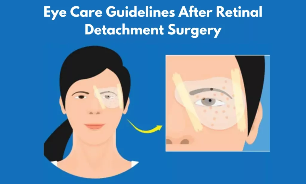 Eye Care Guidelines After Retinal Detachment Surgery