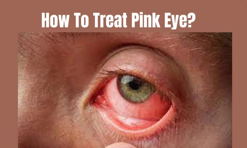 How To Treat Pink Eye