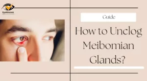 How to Unclog Meibomian Glands_ Everything You Need to Know