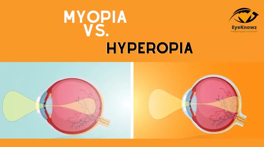 myopia vs hyperopia