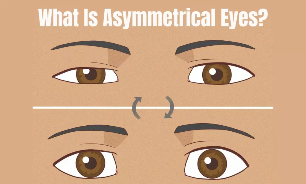 What Is Asymmetrical Eyes