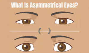 What Is Asymmetrical Eyes